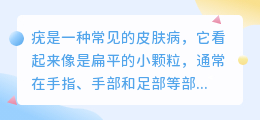 激光提取疣文案