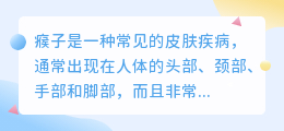 中药提取瘊子文案